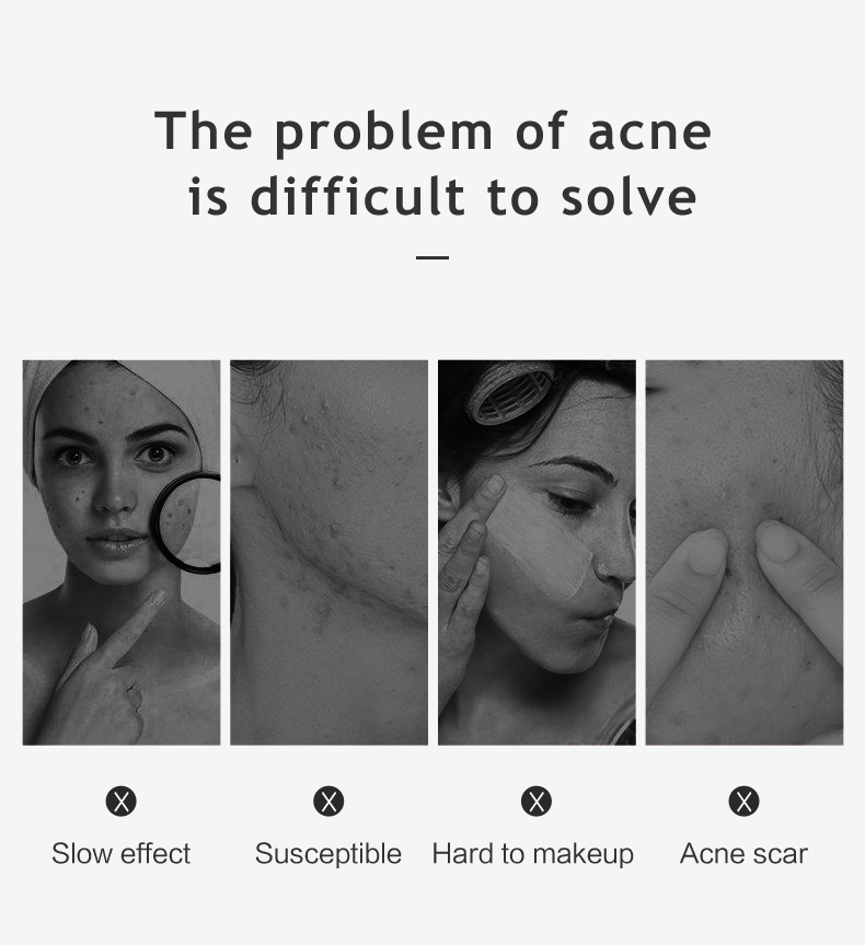 Celecare acne absorbing patch suppliers for men-3