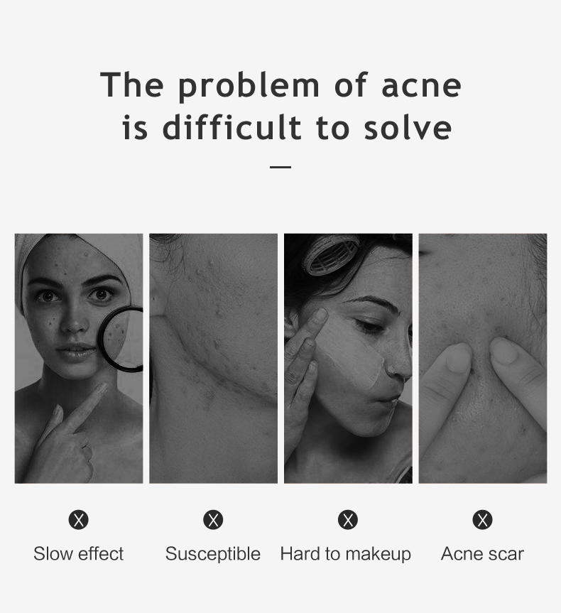 Celecare acne absorbing covers factory direct supply for teen
