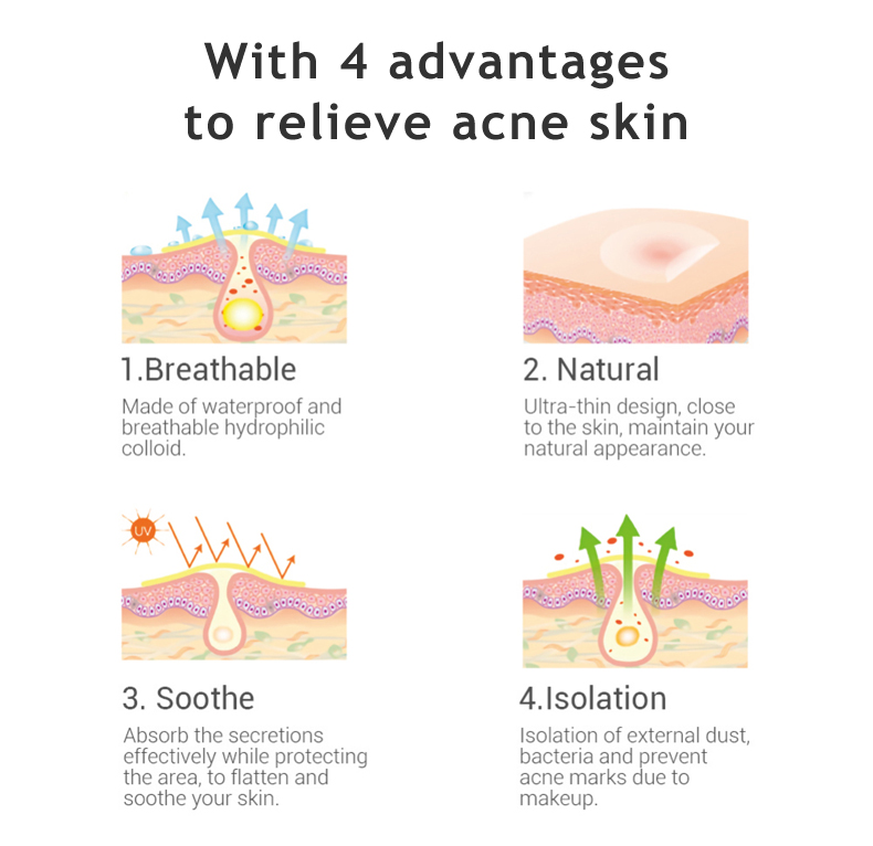 Celecare hydrocolloid dressing acne factory for young people-4