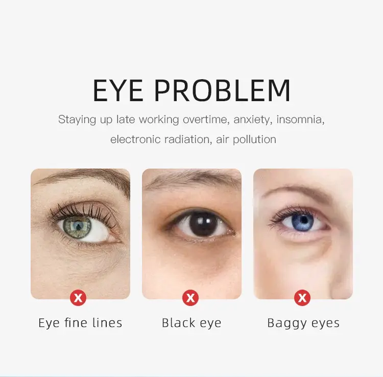 Micro Needle Patch Anti Aging Dark Circle Korean Microneedle Eye Patches Patch for Wrinkles